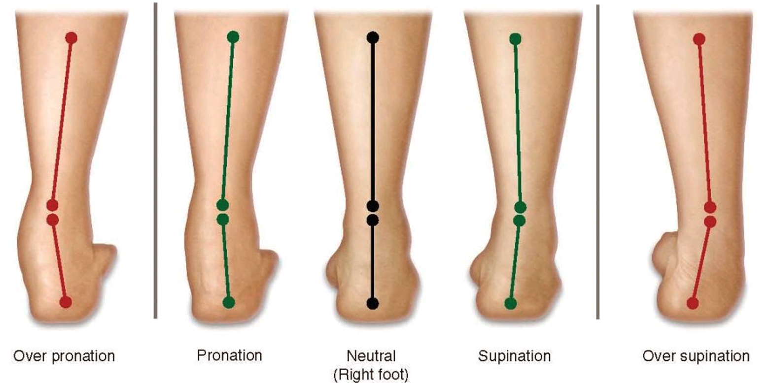 foot alignment for pronation & sublimation